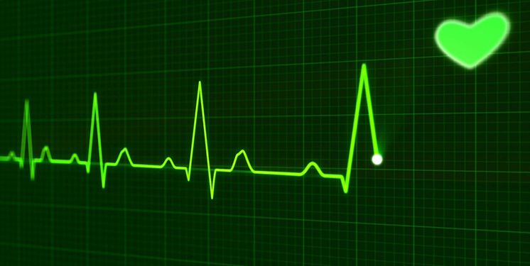 ElectroCardioGraphy (ECG) & Heart Rate (HR) - Technologies